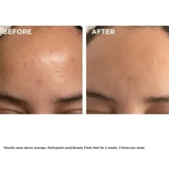 Clarins Exfoliators & Masks<Beauty Flash Peel